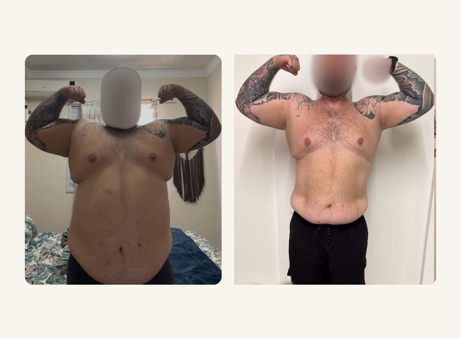 Antes e depois: resultado do Programa Emagrecer com Saúde