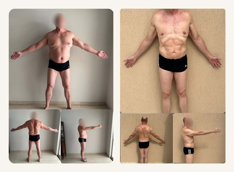 Antes e depois: resultado do Programa Emagrecer com Saúde