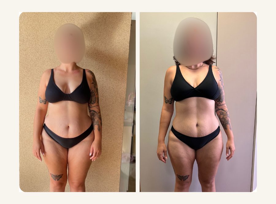 Antes e depois: resultado do Programa Peso Ideal